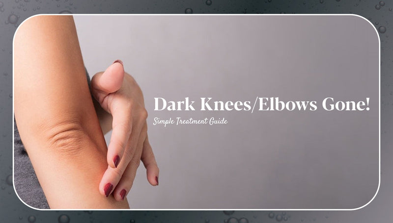 Dark Knees & Elbows: Causes, Treatment & Prevention Tips