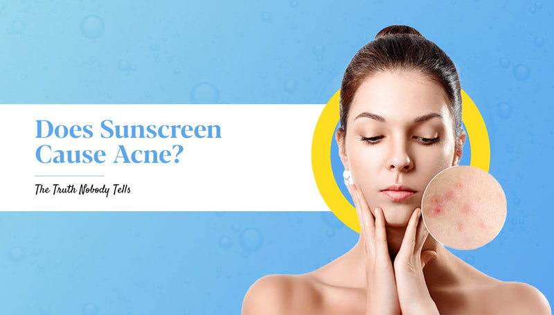 Can Sunscreen Give You Acne? What To Know for Acne-Prone Skin