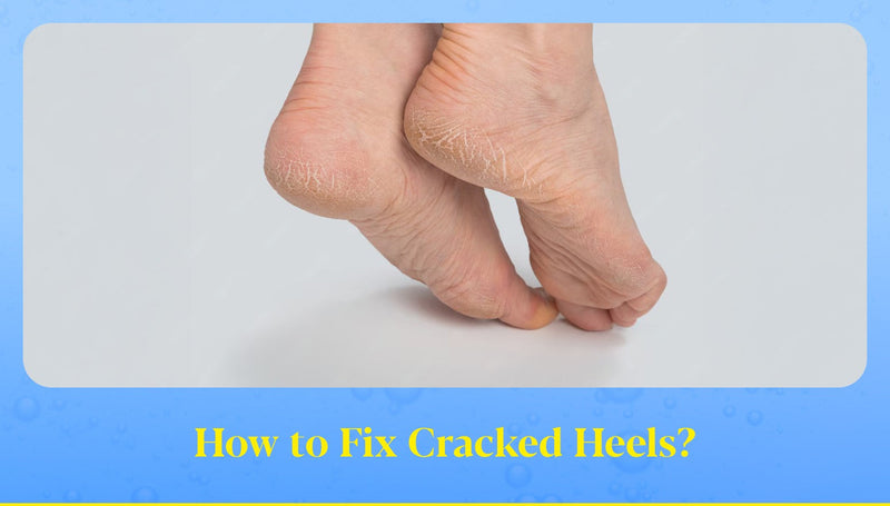 How to Fix Cracked Heels Permanently: Doctor’s Guide to Smooth & Healthy Feet