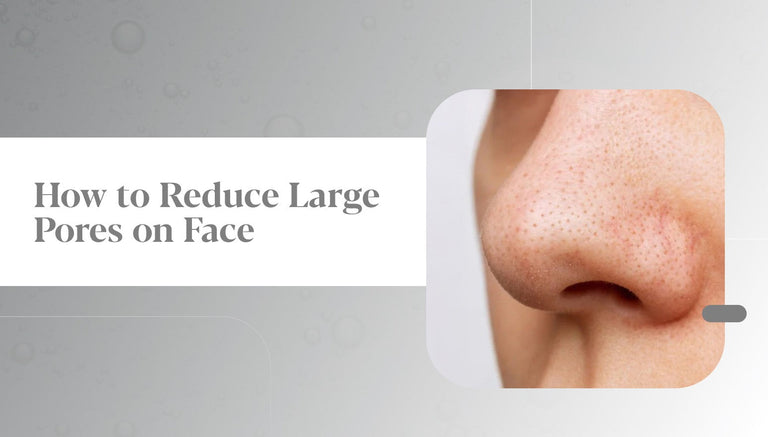 Pores on Your Face: Real Ways to Minimize, Shrink & Tighten Pores