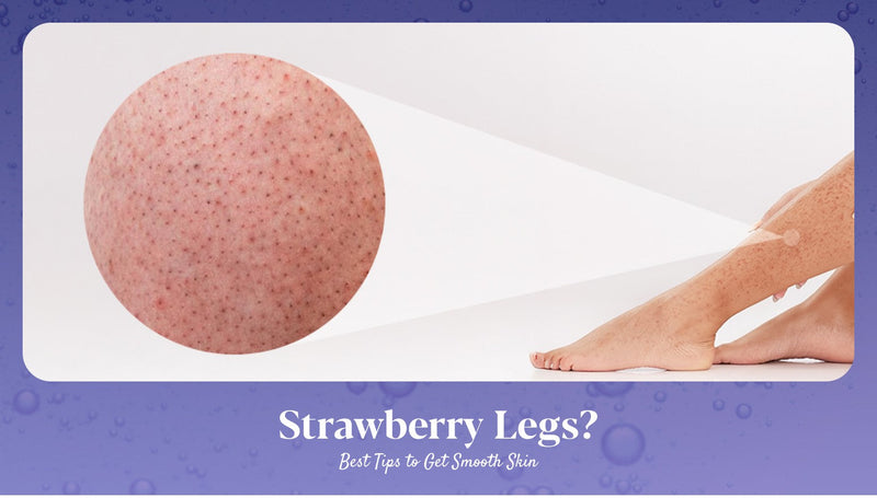 Strawberry Legs: Causes, Treatments & Tips to Prevent Them