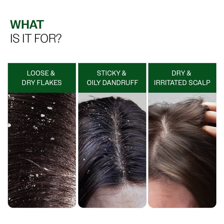 Dandruff Control Duo | Dandruff Shampoo 250 ml & Dandruff Control Spray 200 ml