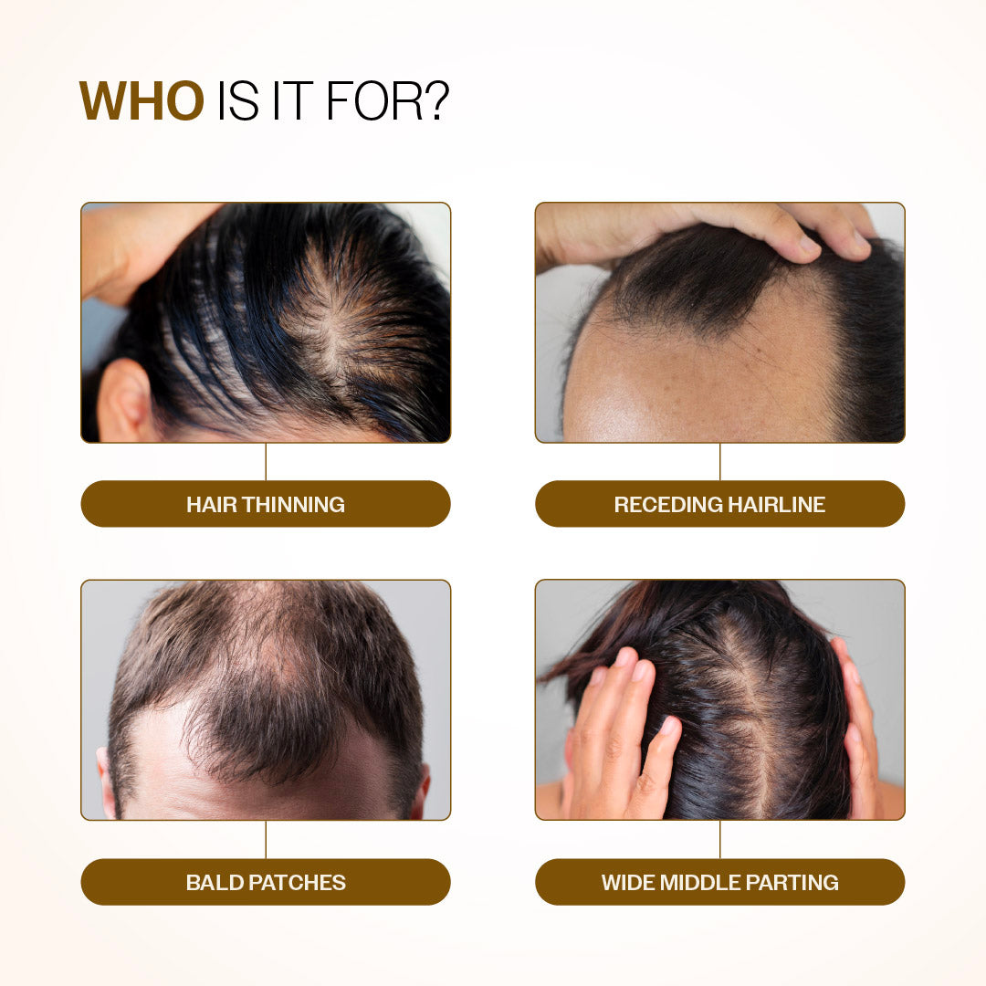 Advanced Hair Growth Serum Roll-On With 5% Rosemary, 4% Anagain, & 3% Redensyl - 25 ml | Pack of 2