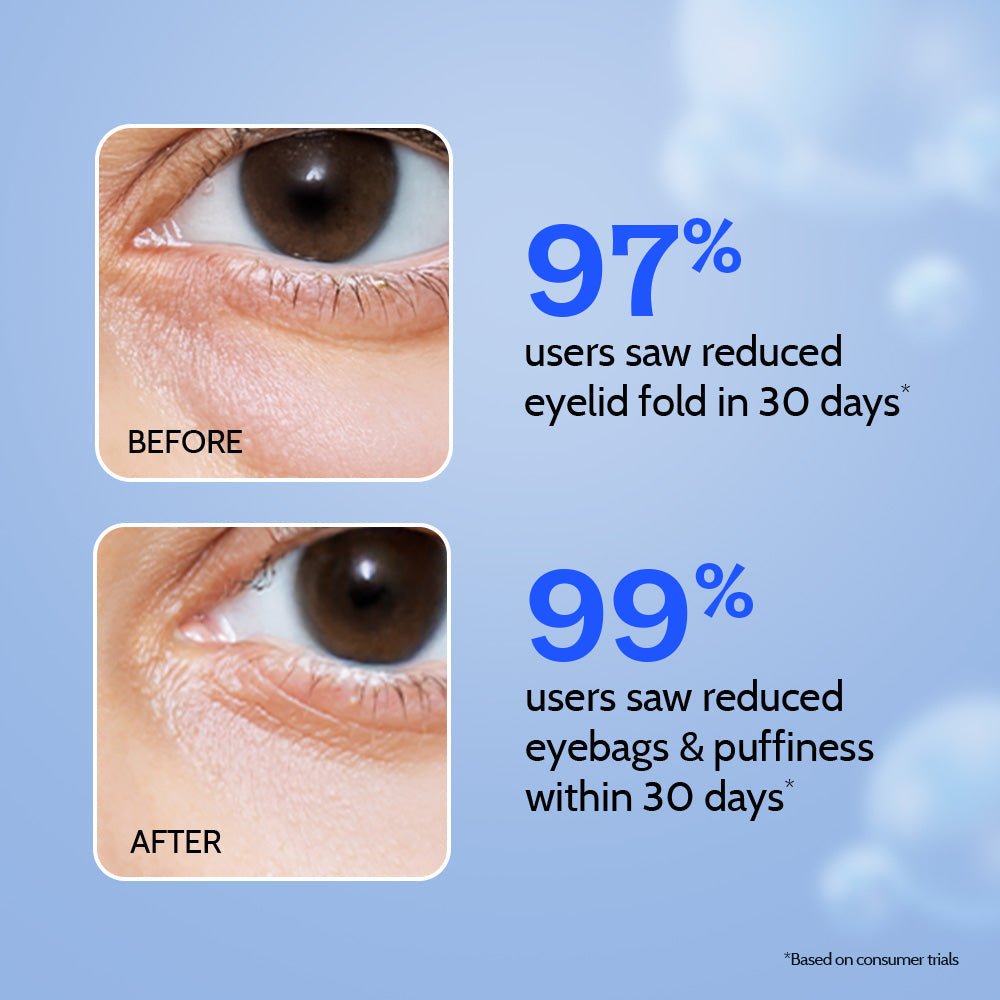 Under Eye Cream for Dark Circles with Caffeine & Green Tea - 15 gm
