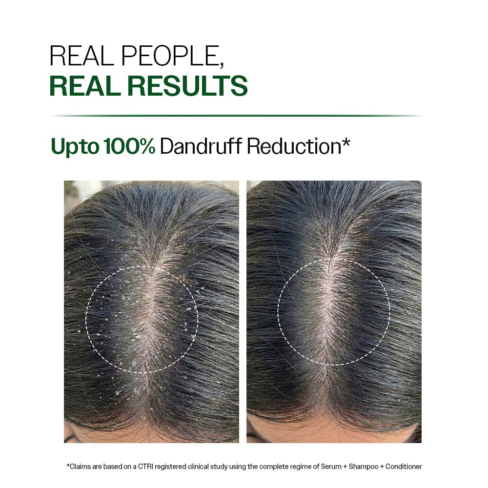 Anti Dandruff Shampoo With Salicylic Acid, Piroctone Olamine & Biotin - 100 ml