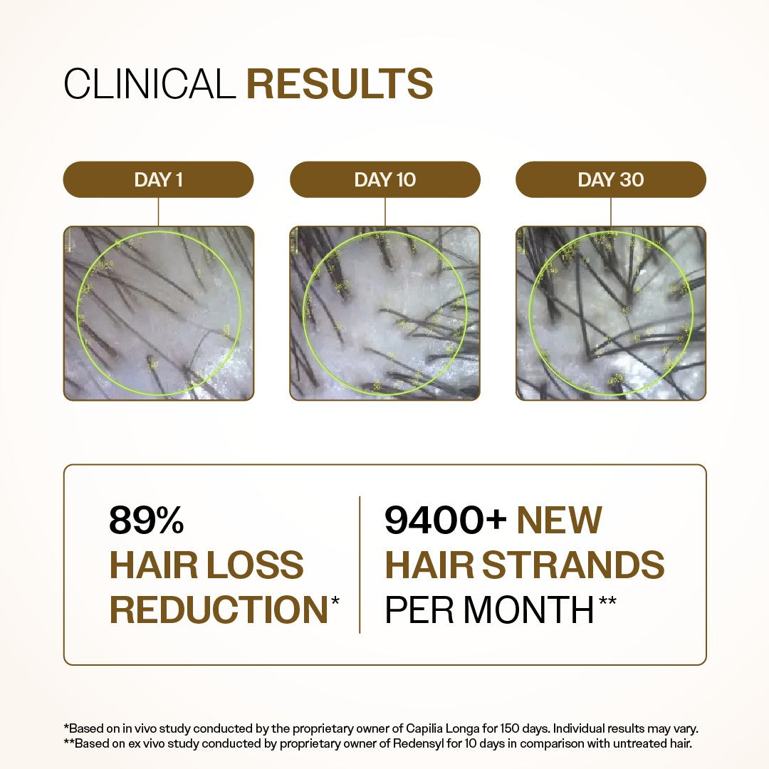 Advanced Hair Growth Serum With 3% Redensyl, 4% Anagain, & 1% Capilia Longa - 30 ml | Pack of 6