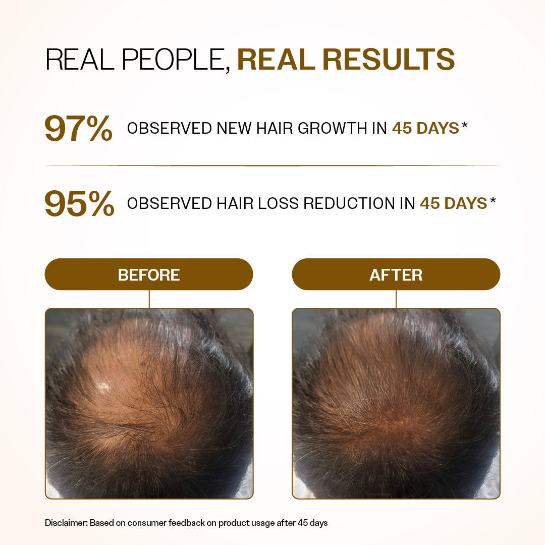 Advanced Hair Growth Serum Roll-On With 5% Rosemary, 4% Anagain, & 3% Redensyl - 25 ml | Pack of 2