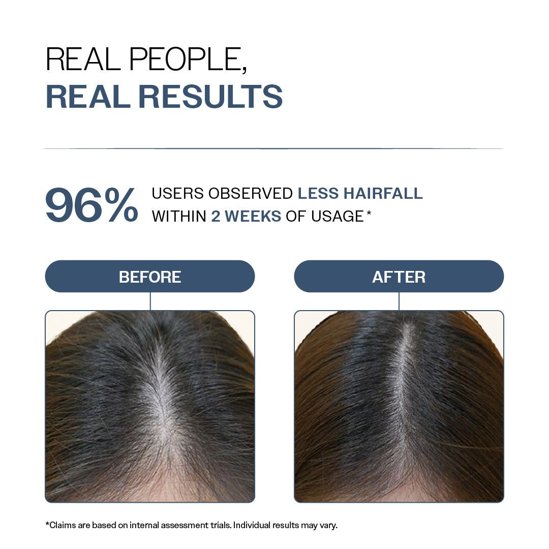 Anti-Hair Fall Shampoo With Adenosine & Peptides for Hair Fall Control - 250 ml  | Pack of 2