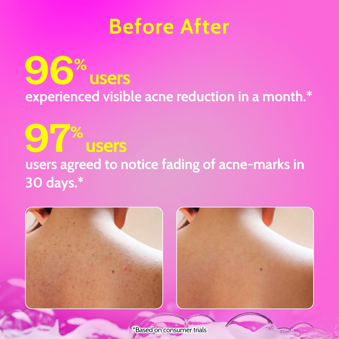 1% Salicylic Acid Body Wash for Body Acne - 236 ml | Pack of 2