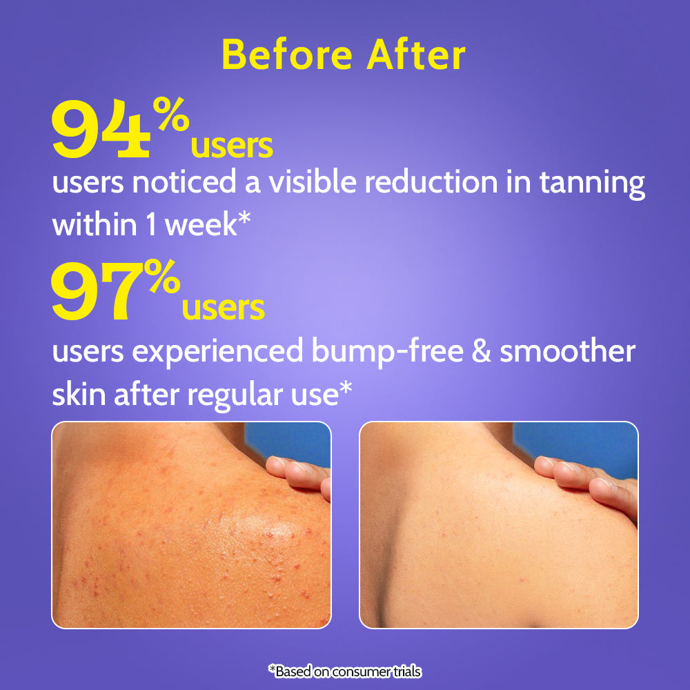 Exfoliating Body Wash with 1% Salicylic Acid & 2% Lactic Acid with Loofah - 236 ml