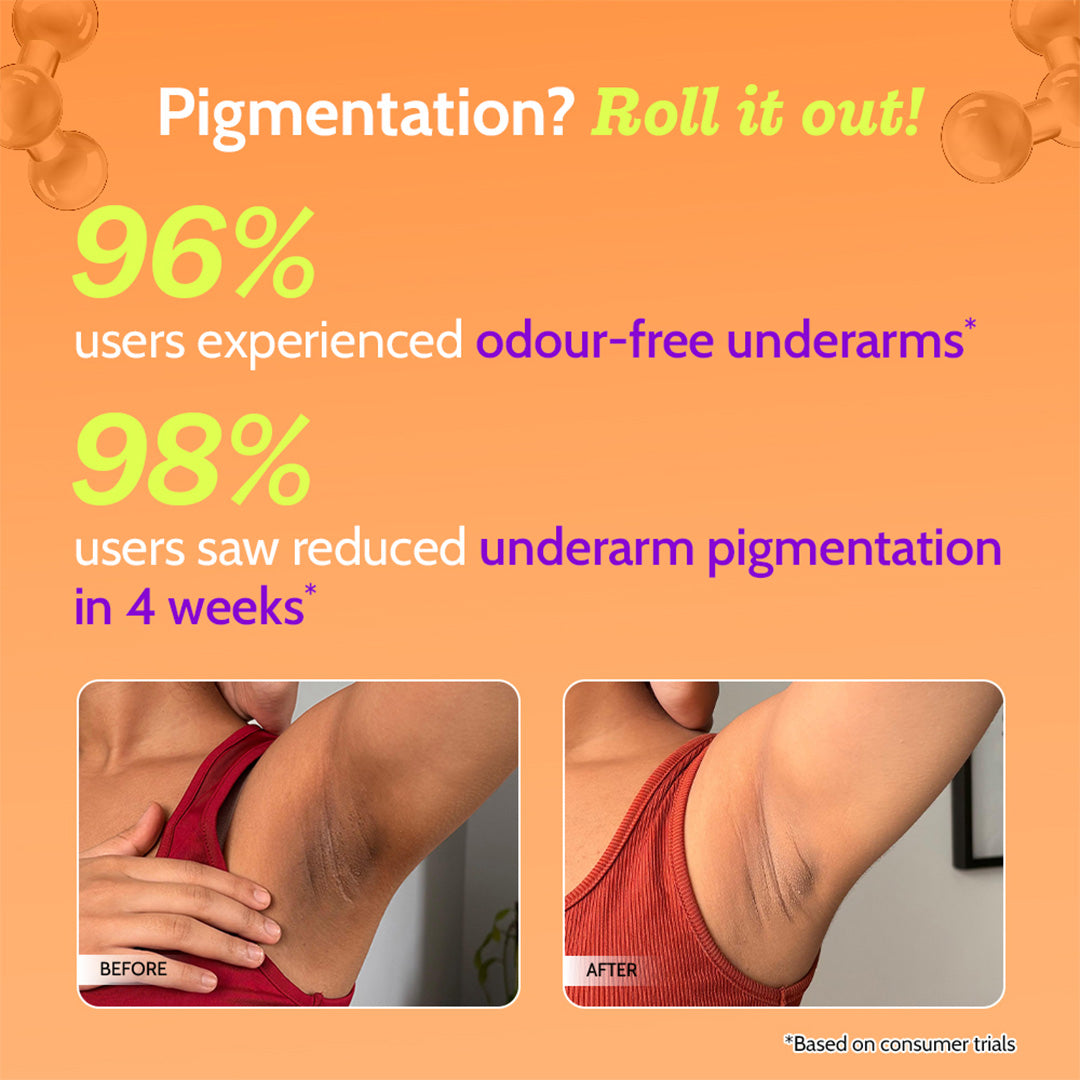 5% AHA Underarm Roll On for Odour Control & Pigmentation (Fragrance Free) - 75 ml