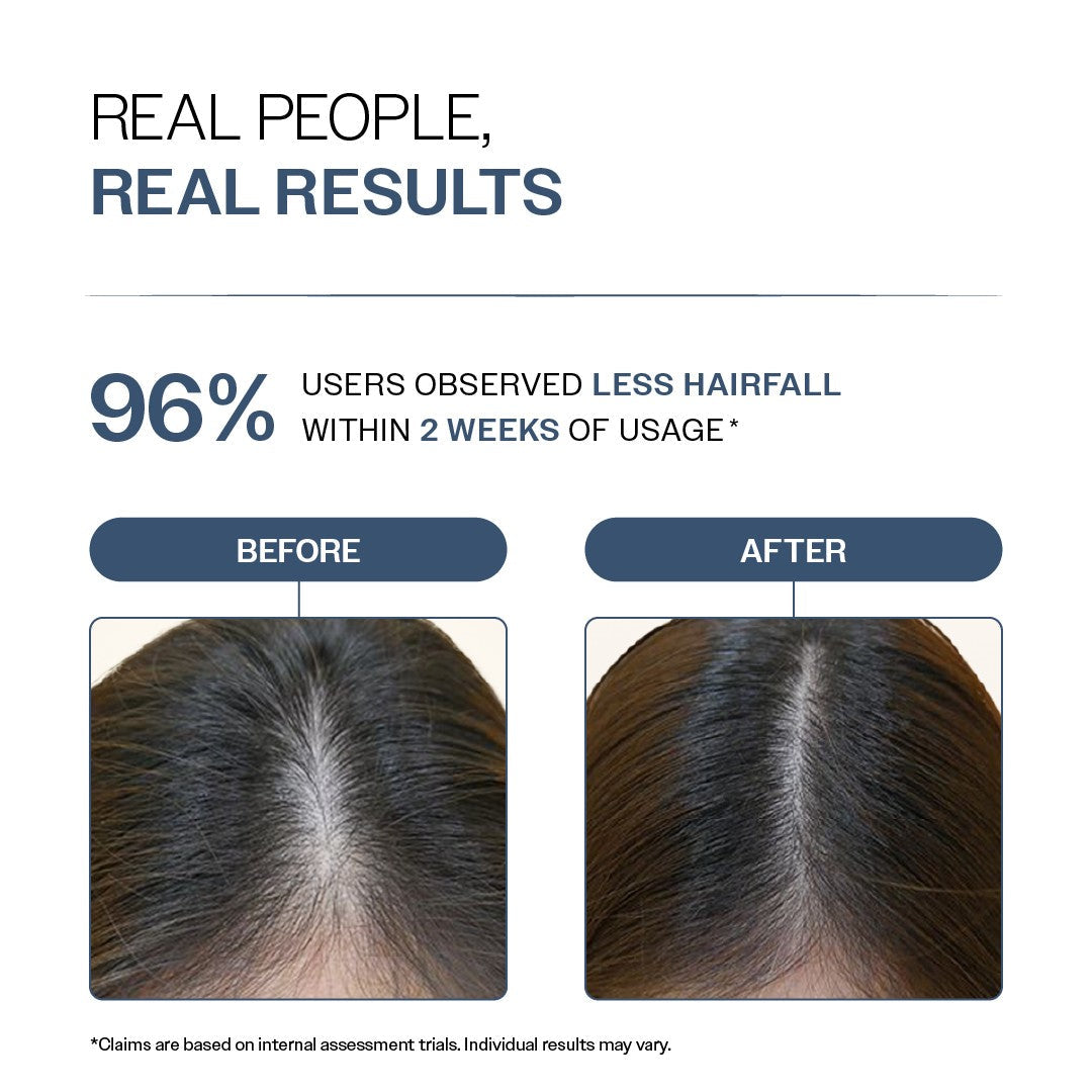 Anti-Hair Fall Shampoo With Adenosine & Peptides for Hair Fall Control - 100 ml | Pack of 2