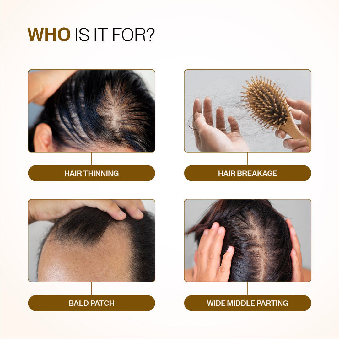 Root Strengthening Duo | Hair Growth Serum 30 ml & Anti-Hairfall Shampoo 100 ml