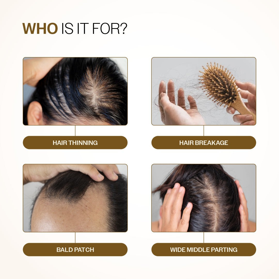 Advanced Hair Growth Serum With 3% Redensyl, 4% Anagain, & 1% Capilia Longa - 30 ml | Pack of 6