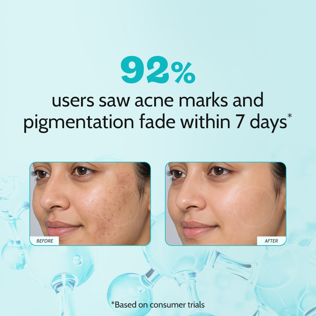 10% Niacinamide Clarifying Face Serum for Hyperpigmentation & Dark Spots -10 ml