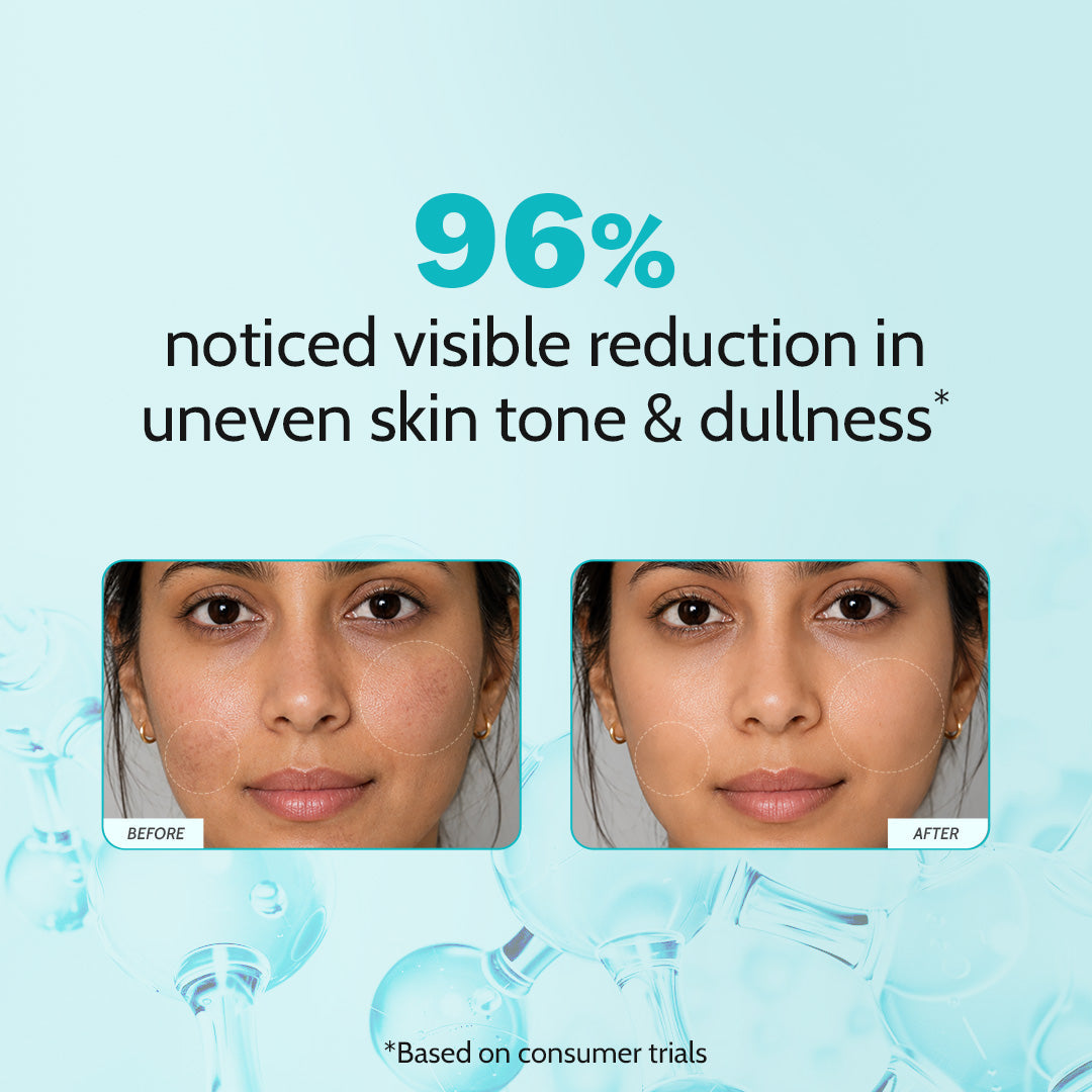 10% Niacinamide Clarifying Face Serum for Hyperpigmentation & Dark Spots -10 ml