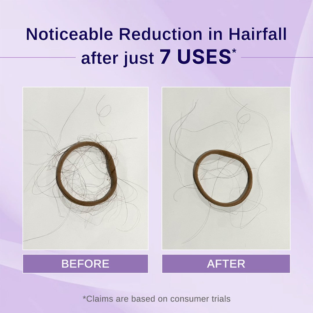 Rosemary & Hibiscus Hair Growth Oil With Redensyl, Biotin, Bhringraj & Aloe Vera - 100 ml
