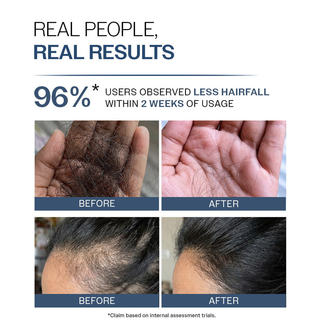 Anti-Hair Fall Shampoo With Adenosine & Peptides for Hair Fall Control - 750 ml