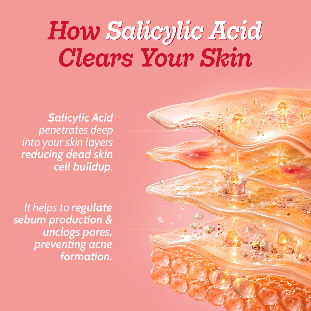 2% Salicylic Acid Face Serum With Lactic Acid For Acne Control  - 30 ml