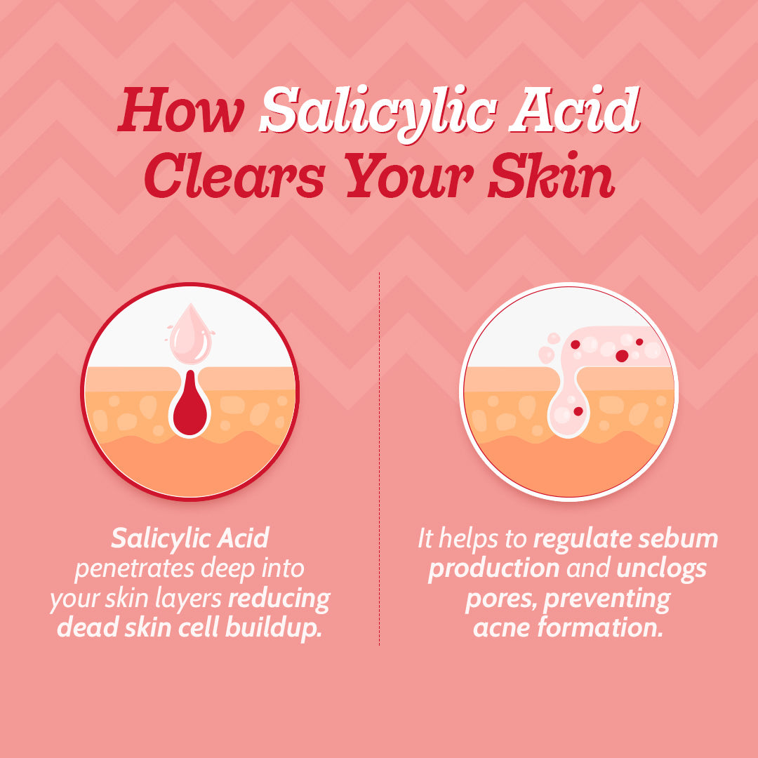 2% Salicylic Acid Face Serum With Lactic Acid For Acne Control  - 30 ml