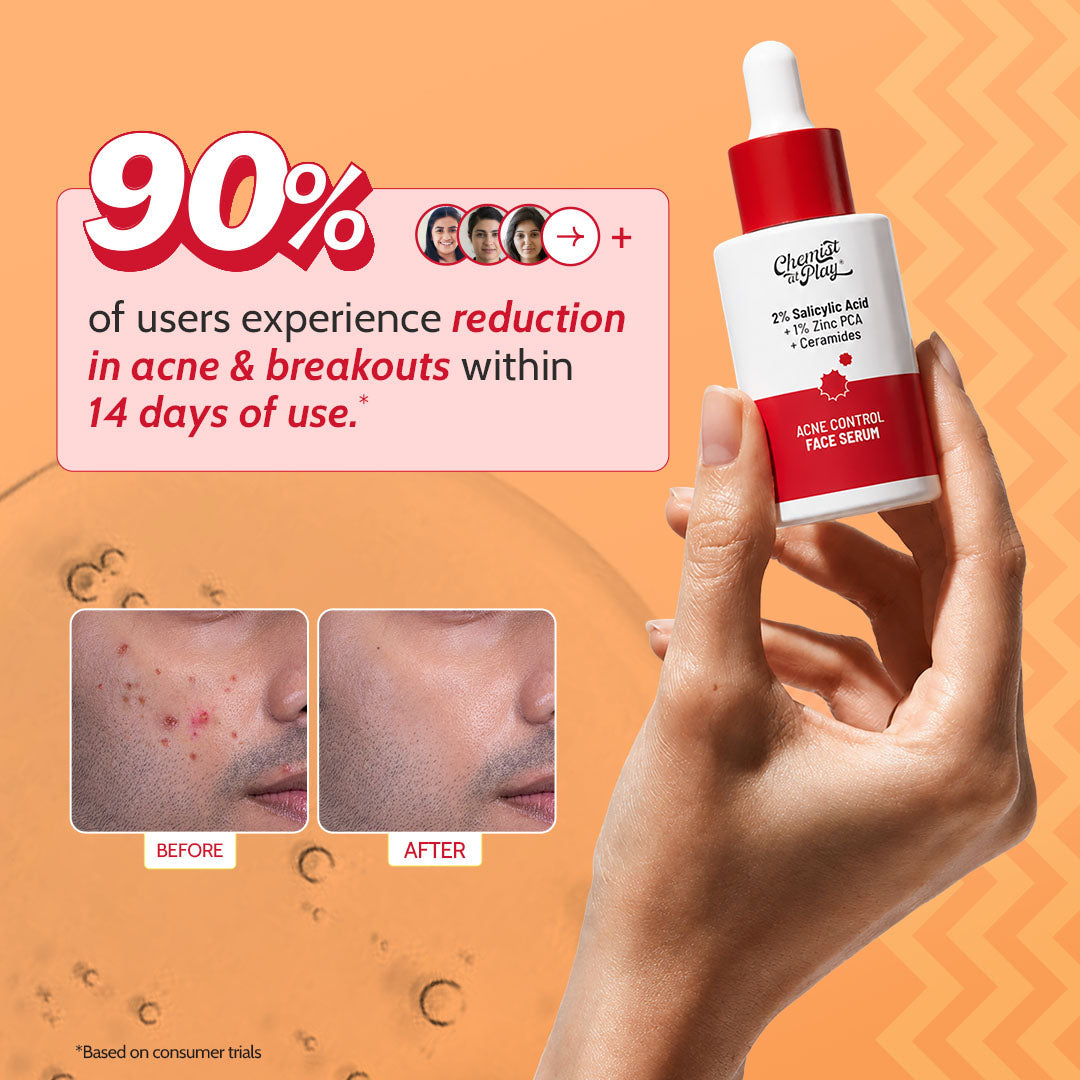 2% Salicylic Acid Face Serum With Lactic Acid For Acne Control  - 30 ml