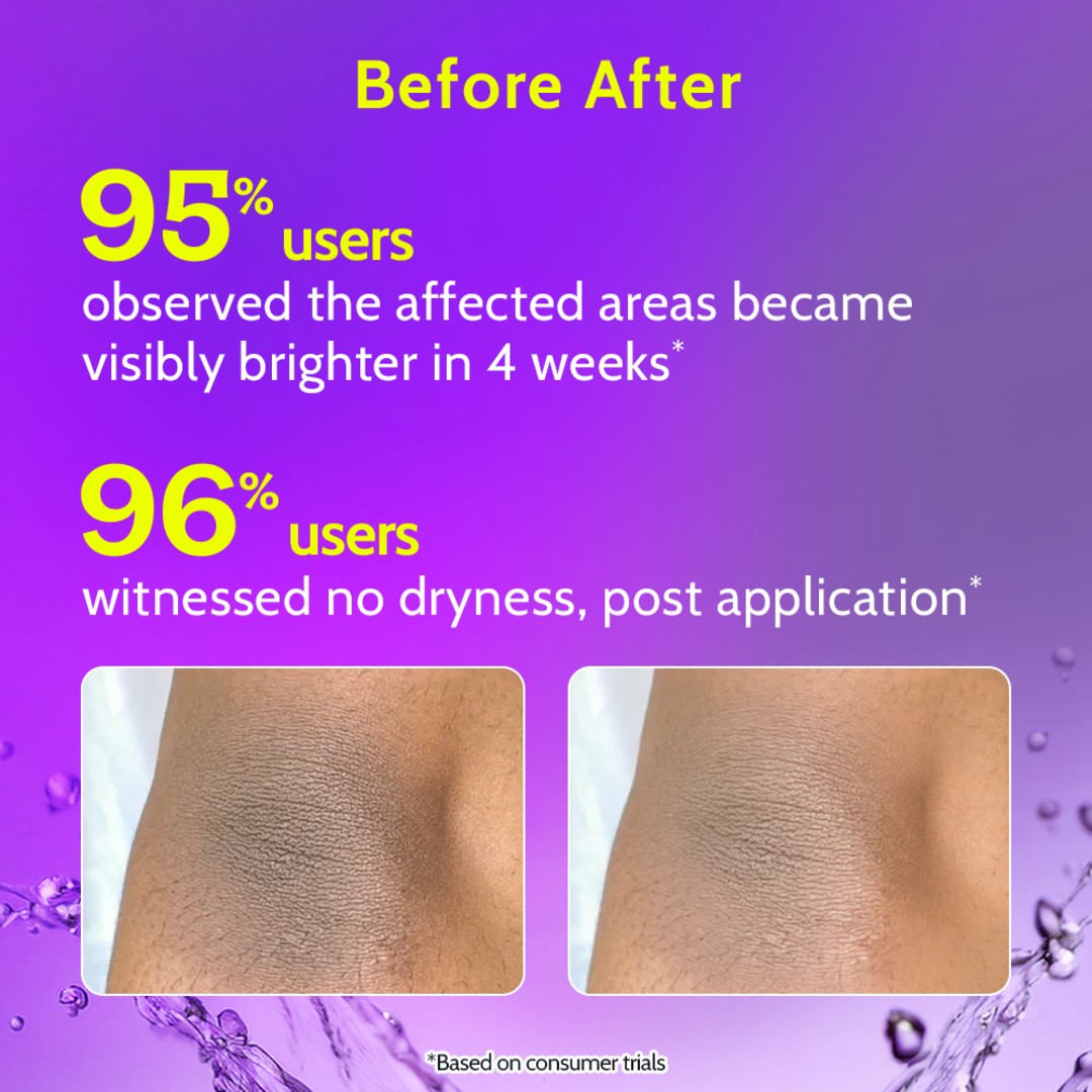 Neck, Knee & Elbow Brightening Roll On With Mandelic Acid & Niacinamide - 40 ml | Pack of 2