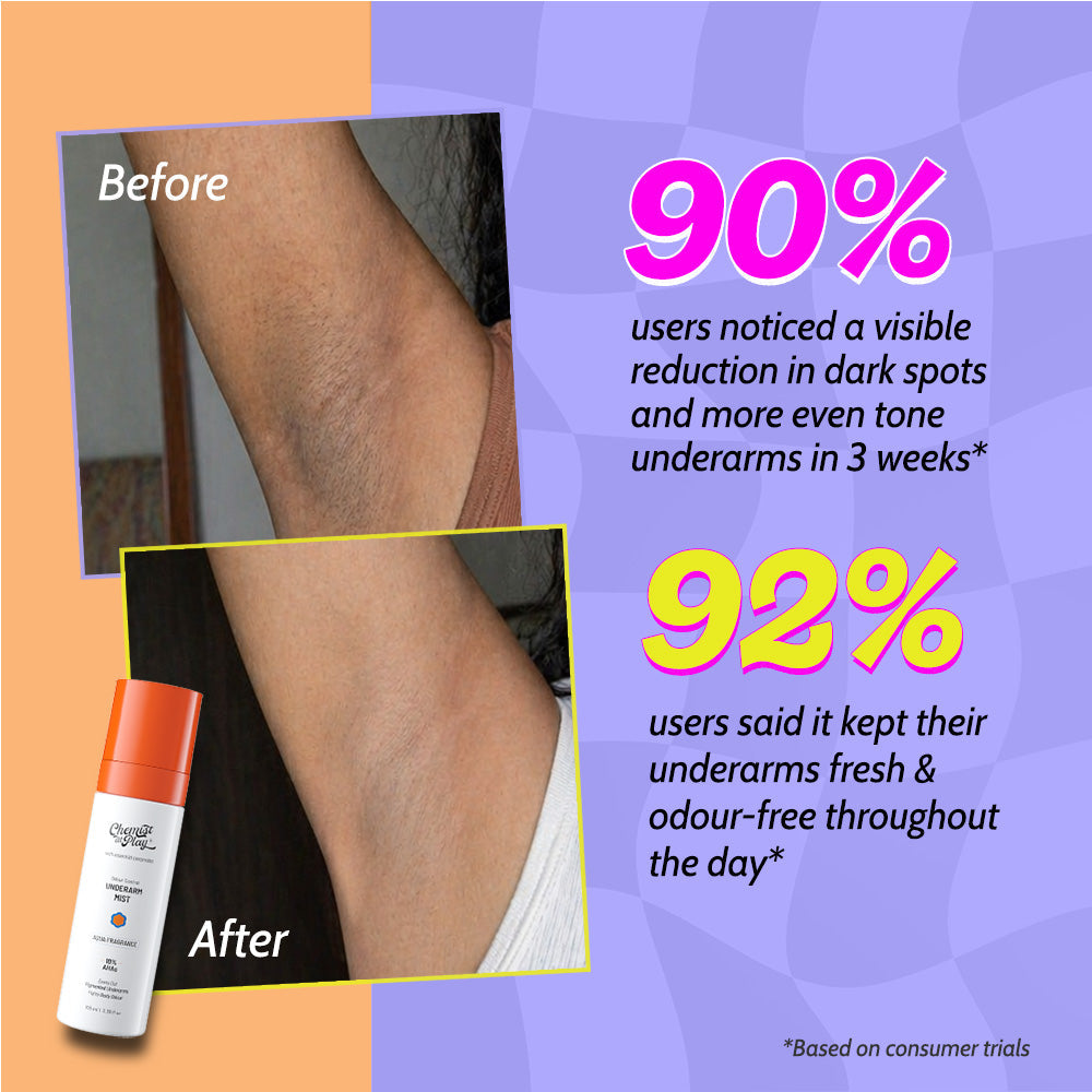 Exfoliating Underarm Mist for Pigmentation & Odour Control - 100 ml