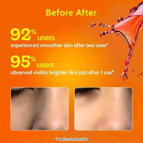 26% AHA + 4% PHA + 2% BHA Exfoliating Peeling Solution for Tan Removal & Pigmentation - 30 ml | Pack of 2