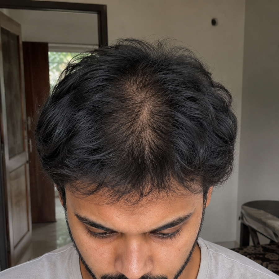 Week 3