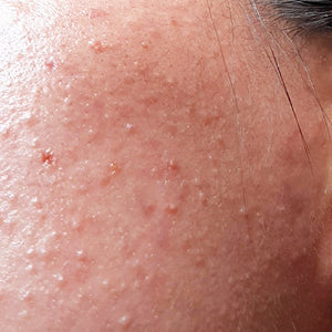 Bumpy Skin image
