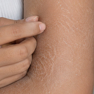 Dryness image