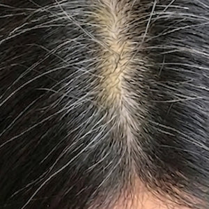Grey Hair image