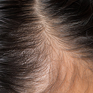 Hair Growth image