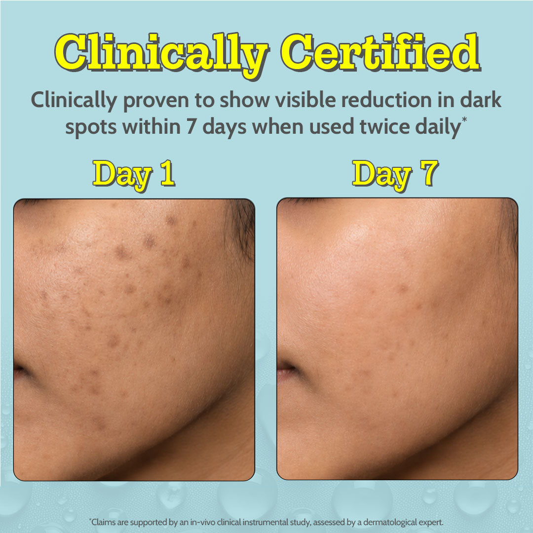 10% Vitamin C Serum for Glowing & Bright Skin - 30 ml | Pack of 3