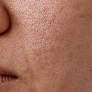 Uneven Skin image